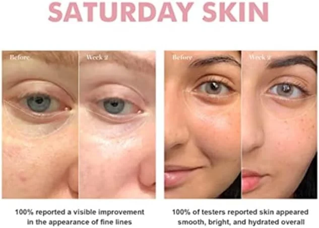 کرم روشن کننده دور چشم Saturday Skin، Wide Awake، 30 میلی لیتر