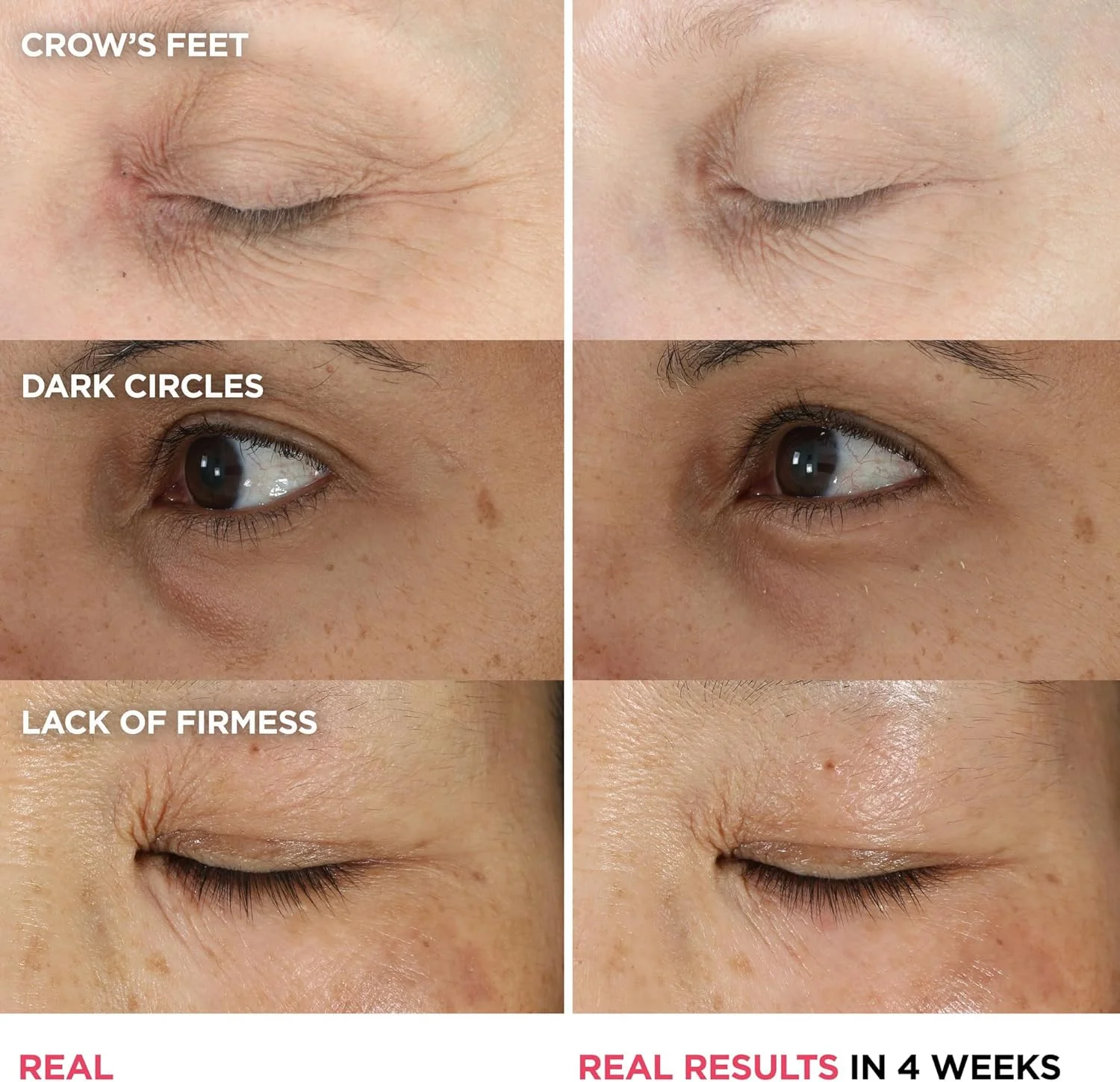 کرم دور چشم IT Cosmetics Confidence - کرم دور چشم پپتیدی ضد پیری برای تیرگی و چروک، آبرسانی سبک 48 ساعته، 2% کنسانتره سوپر پپتید، صاف و روشن کننده زیر چشم - 15 میلی لیتر