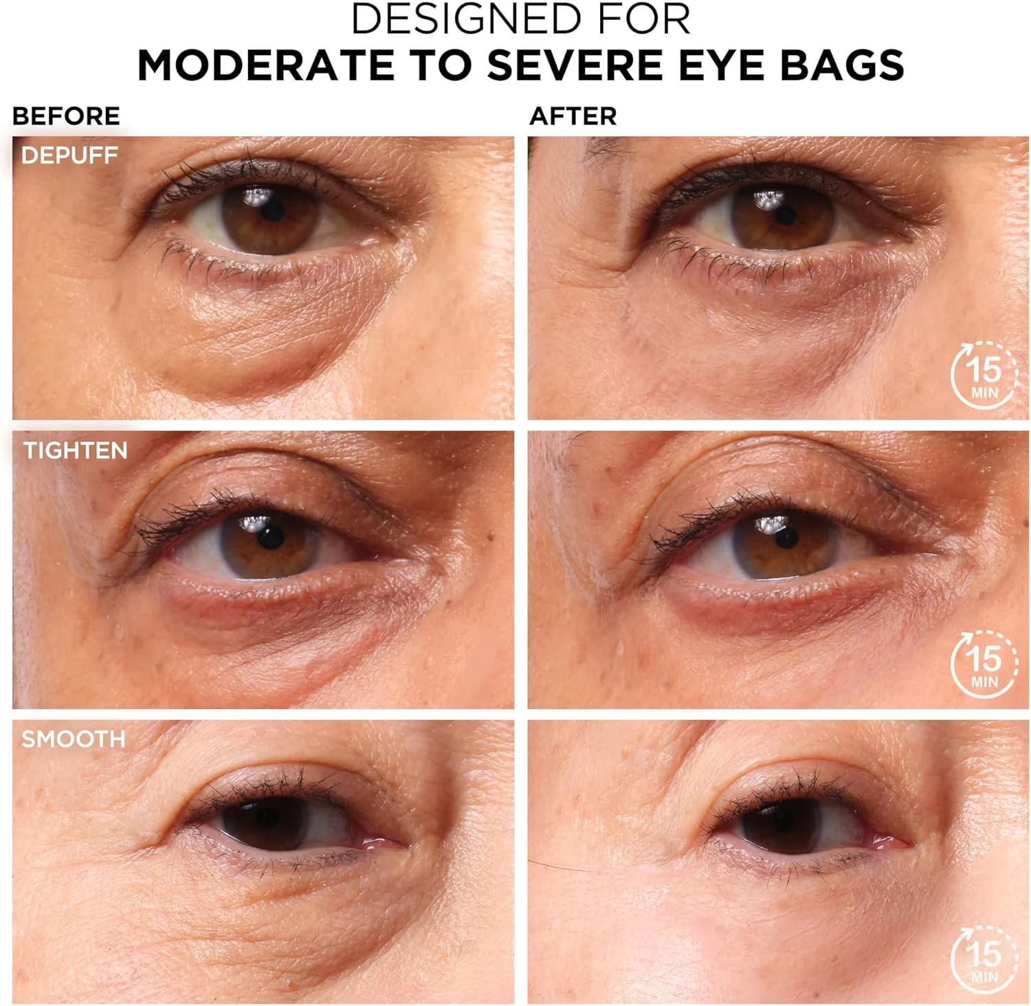 درمان پف زیر چشم IT Cosmetics Bye Bye برای زنان و مردان - کاهش دهنده موقت پف زیر چشم و اصلاح کننده زیر چشم، پف را از بین می برد، سفت می کند، صاف می کند و ظاهر چین و چروک و خطوط ریز را کاهش می دهد - 15 میلی لیتر درمان پف زیر چشم IT Cosmetics Bye Bye برای زنان و مردان - کاهش دهنده موقت پف زیر چشم و اصلاح کننده زیر چشم، پف را از بین می برد، سفت می کند، صاف می کند و ظاهر چین و چروک و خطوط ریز را کاهش می دهد - 15 میلی لیتر