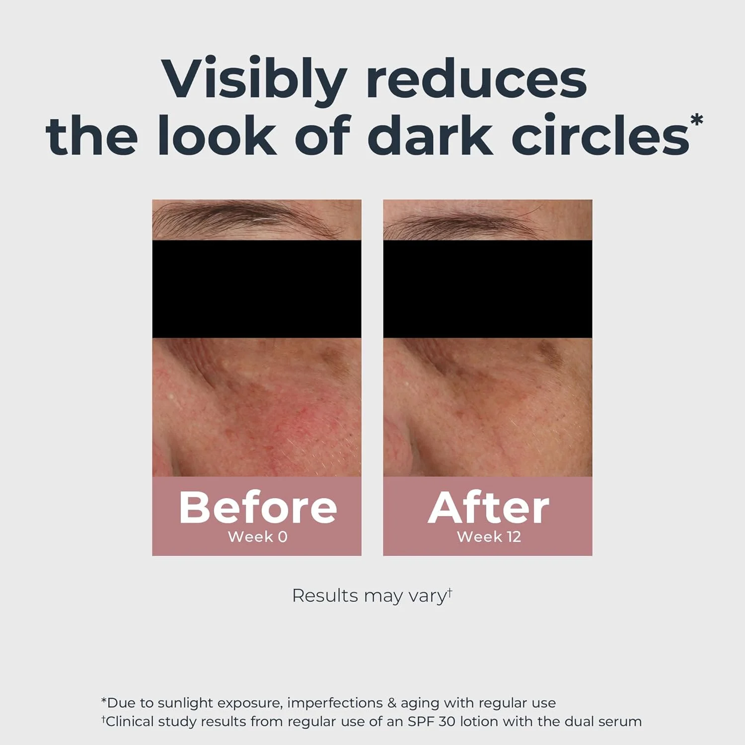 کرم دور چشم روشن کننده و اصلاح کننده تیرگی دور چشم اوسرین، حاوی تیامیدول و هیالورونیک اسید، کمک به کاهش پف زیر چشم، 15 میلی لیتر