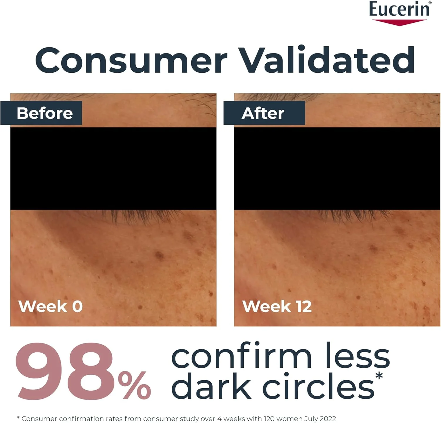 کرم دور چشم روشن کننده و اصلاح کننده تیرگی دور چشم اوسرین، برای ظاهری شاداب و بیدار و کاهش تیرگی دور چشم با تیامیدول، موثر در 2 هفته، 15 میلی لیتر کرم دور چشم روشن کننده و اصلاح کننده تیرگی دور چشم اوسرین، برای ظاهری شاداب و بیدار و کاهش تیرگی دور چشم با تیامیدول، موثر در 2 هفته، 15 میلی لیتر