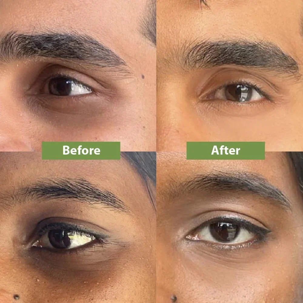 کرم دور چشم ویلوه استور | برای سیاهی دور چشم، پف چشم، خطوط ریز و چروک | کاهش تیرگی، ظاهر خسته، چروک و پف دور چشم | با مواد طبیعی، 20 میلی لیتر کرم دور چشم ویلوه استور | برای سیاهی دور چشم، پف چشم، خطوط ریز و چروک | کاهش تیرگی، ظاهر خسته، چروک و پف دور چشم | با مواد طبیعی، 20 میلی لیتر