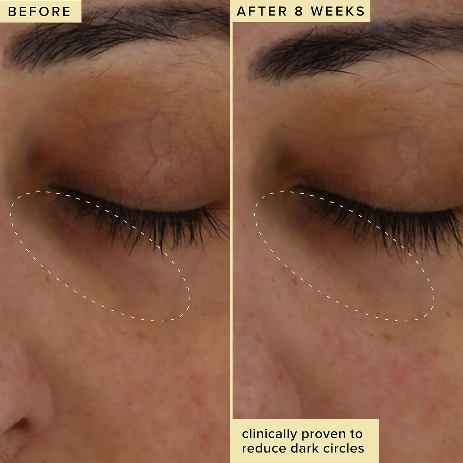 کرم روشن کننده دور چشم فارماسی - کرم دور چشم Wake Up Honey برای حلقه های تیره + پف کردگی - غنی شده با ویتامین C + پپتید کرنبری برای صاف کردن چین و چروک ها در طول زمان (15 میلی لیتر)