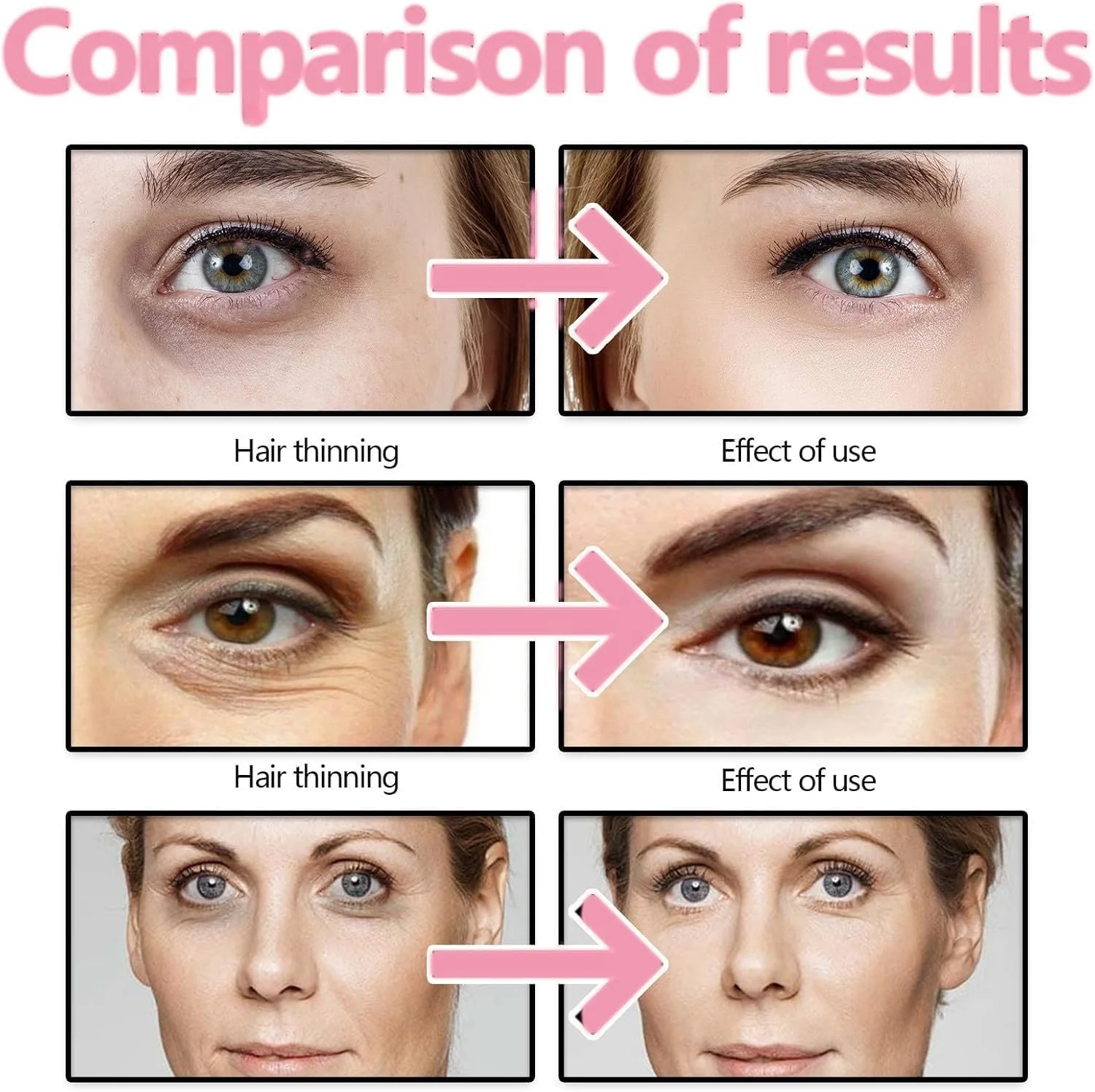 کرم دور چشم کافئین، کرم زیر چشم برای حلقه های تیره و پف کردگی، کرم روز و شب، کاهش خطوط ریز و ضد پیری، برای حلقه های تیره، پف و کیسه های زیر چشم کرم دور چشم کافئین، کرم زیر چشم برای حلقه های تیره و پف کردگی، کرم روز و شب، کاهش خطوط ریز و ضد پیری، برای حلقه های تیره، پف و کیسه های زیر چشم