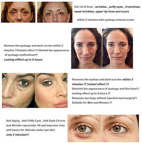 کرم دور چشم جادویی، فورا پف، تیرگی و خطوط ریز زیر چشم را از بین می برد، کرم دور چشم ضد پیری برای مردان و زنان، رنگ پوست ناهموار را بهبود می بخشد کرم دور چشم جادویی، فورا پف، تیرگی و خطوط ریز زیر چشم را از بین می برد، کرم دور چشم ضد پیری برای مردان و زنان، رنگ پوست ناهموار را بهبود می بخشد
