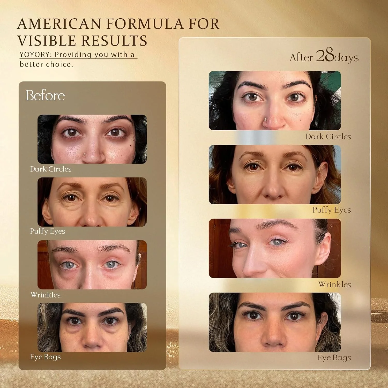 کرم دور چشم رتینول - کرم دور چشم ضد پیری برای تیرگی و پف زیر چشم، آبرسان عمیق، کرم لیفتینگ فوری چشم خشک، کرم دور چشم کره ای برای زنان (15 میلی لیتر) کرم دور چشم رتینول - کرم دور چشم ضد پیری برای تیرگی و پف زیر چشم، آبرسان عمیق، کرم لیفتینگ فوری چشم خشک، کرم دور چشم کره ای برای زنان (15 میلی لیتر)