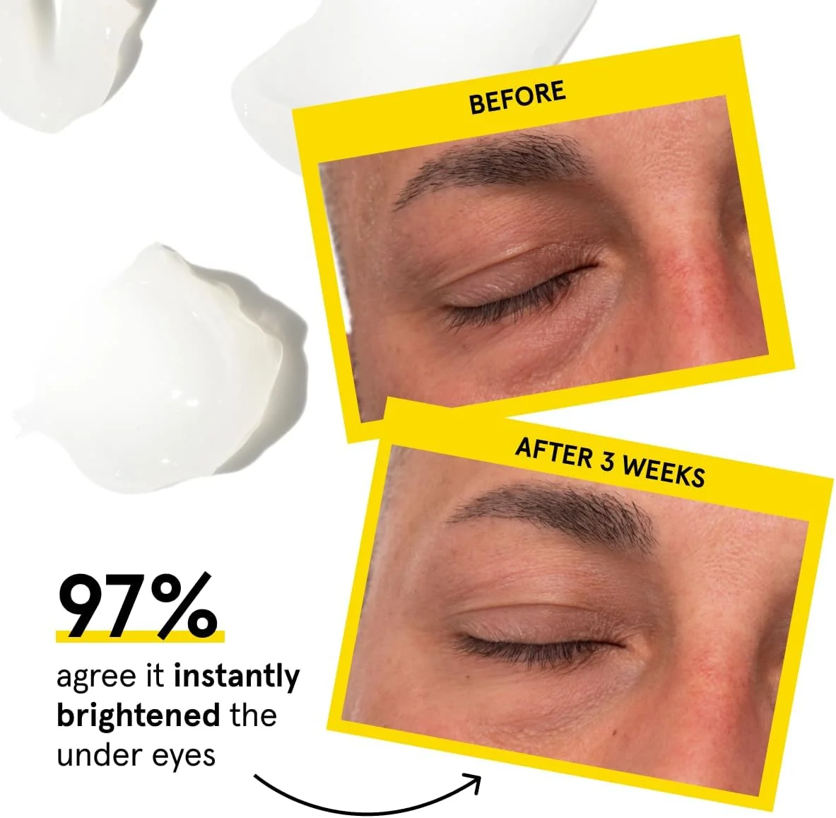 بالم دفاعی دور چشم لومین - کرم دور چشم ضد پیری با فرمولاسیون کره‌ای برای حلقه‌های تیره، خطوط ریز و چین و چروک، مناسب برای انواع پوست، استفاده روزانه، 20 میلی لیتر، 1 عددی