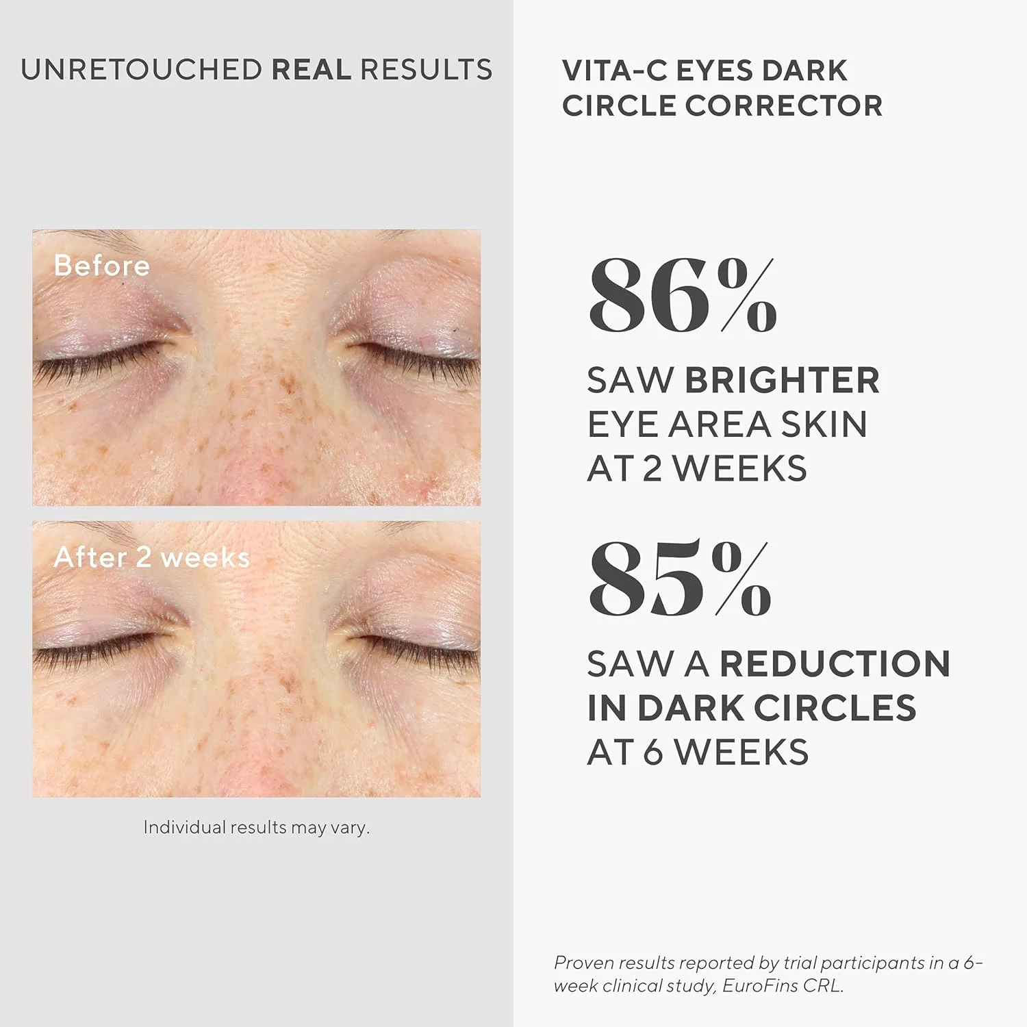 سرم دور چشم ویتامین C Murad Environmental Shield VITA-C، اصلاح کننده تیرگی دور چشم، 15 میلی لیتر