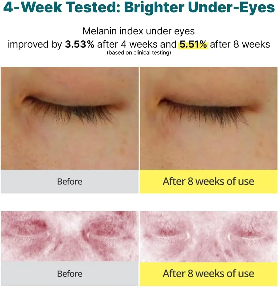 کرم دور چشم ویتامین C نارنگی سبز گودال | درمان تیرگی دور چشم و افزایش خاصیت ارتجاعی، ملایم، بدون ایجاد حساسیت، مراقبت ضد پیری و ضد چروک (30 میلی لیتر) کرم دور چشم ویتامین C نارنگی سبز گودال | درمان تیرگی دور چشم و افزایش خاصیت ارتجاعی، ملایم، بدون ایجاد حساسیت، مراقبت ضد پیری و ضد چروک (30 میلی لیتر)