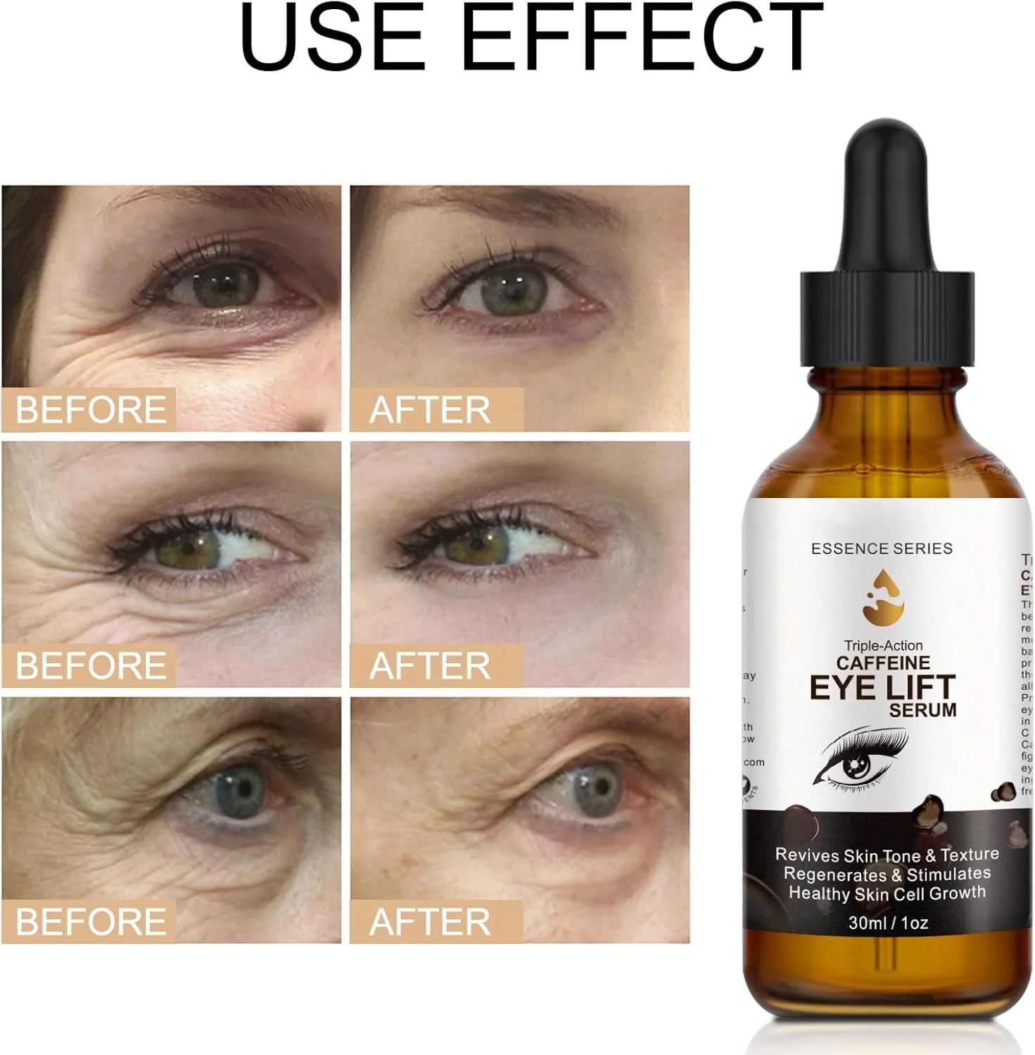 سرم دور چشم کافئین - کرم دور چشم برای سیاهی و پف، با EGCG، آسکوربیک اسید و کلاژن. سرم لیفتینگ دور چشم کافئین، کیسه های زیر چشم، چین و چروک و خطوط ریز را کاهش می دهد - 60 میلی لیتر سرم دور چشم کافئین - کرم دور چشم برای سیاهی و پف، با EGCG، آسکوربیک اسید و کلاژن. سرم لیفتینگ دور چشم کافئین، کیسه های زیر چشم، چین و چروک و خطوط ریز را کاهش می دهد - 60 میلی لیتر