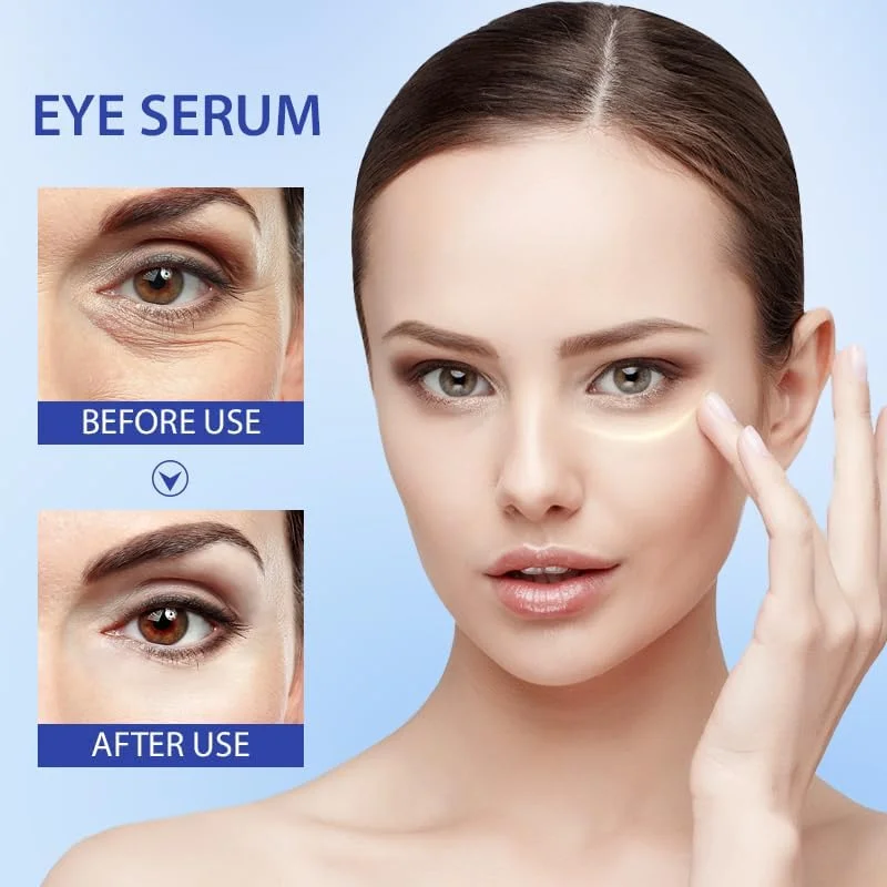 کرم دور چشم رتینول با کافئین - کرم دور چشم سفت کننده برای حلقه های تیره و پف کردگی - کرم دور چشم ضد پیری برای چین و چروک کرم دور چشم رتینول با کافئین - کرم دور چشم سفت کننده برای حلقه های تیره و پف کردگی - کرم دور چشم ضد پیری برای چین و چروک