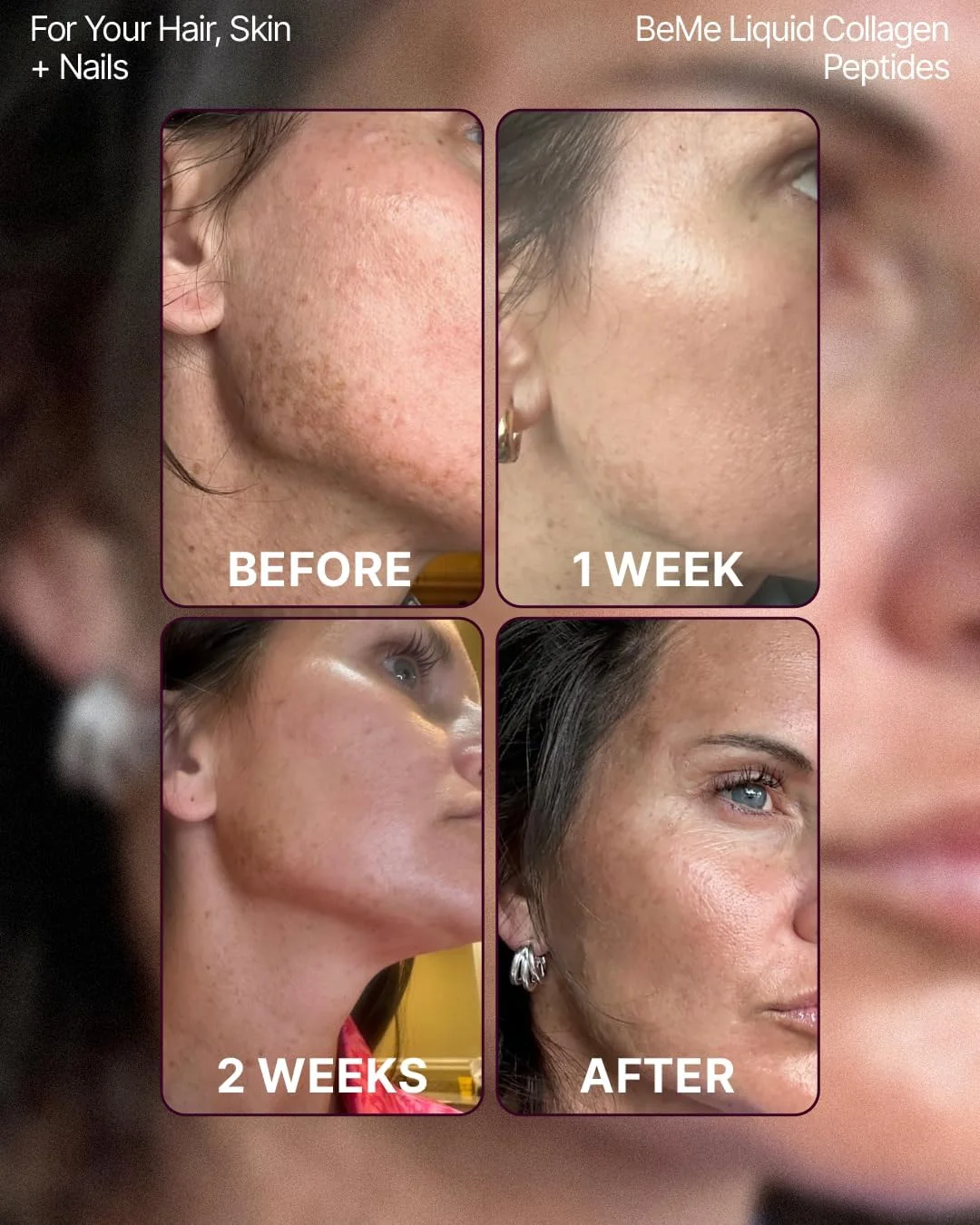 کلاژن مایع BeMe برای بانوان - 2500 میلی گرم کلاژن مایع دریایی هیدرولیز شده Verisol - مکمل های کلاژن تست شده بالینی - جذب سریع، فراهمی زیستی بالا - پشتیبانی از پوست، مو و ناخن کلاژن مایع BeMe برای بانوان - 2500 میلی گرم کلاژن مایع دریایی هیدرولیز شده Verisol - مکمل های کلاژن تست شده بالینی - جذب سریع، فراهمی زیستی بالا - پشتیبانی از پوست، مو و ناخن