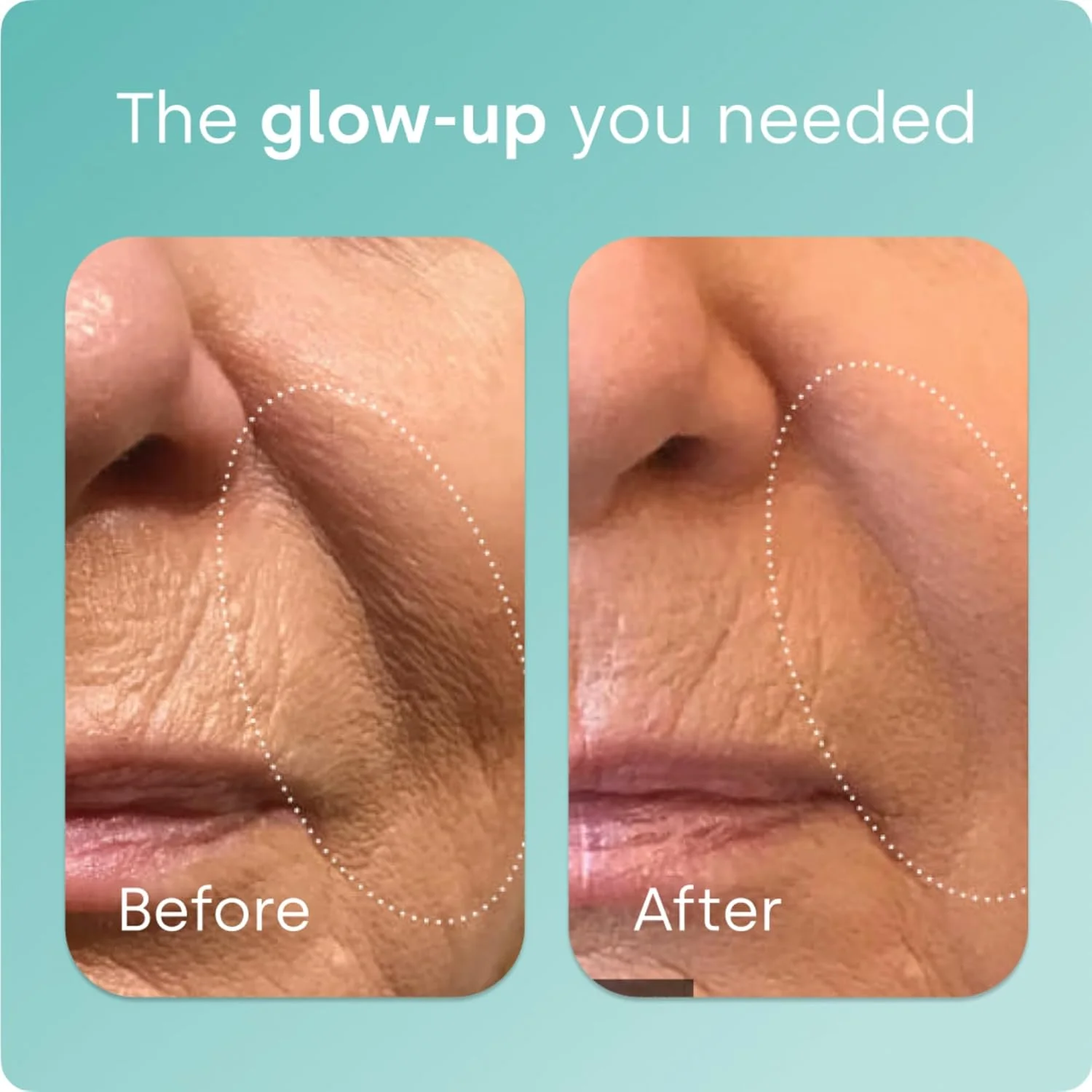 مکمل تقویت کننده کلاژن بای سیل - قطره 15 میلی لیتری - فعال کننده ثبت شده ch-OSA برای پوست، مو، ناخن و مفاصل - پشتیبانی از تولید طبیعی - تامین 30 روزه مکمل تقویت کننده کلاژن بای سیل - قطره 15 میلی لیتری - فعال کننده ثبت شده ch-OSA برای پوست، مو، ناخن و مفاصل - پشتیبانی از تولید طبیعی - تامین 30 روزه