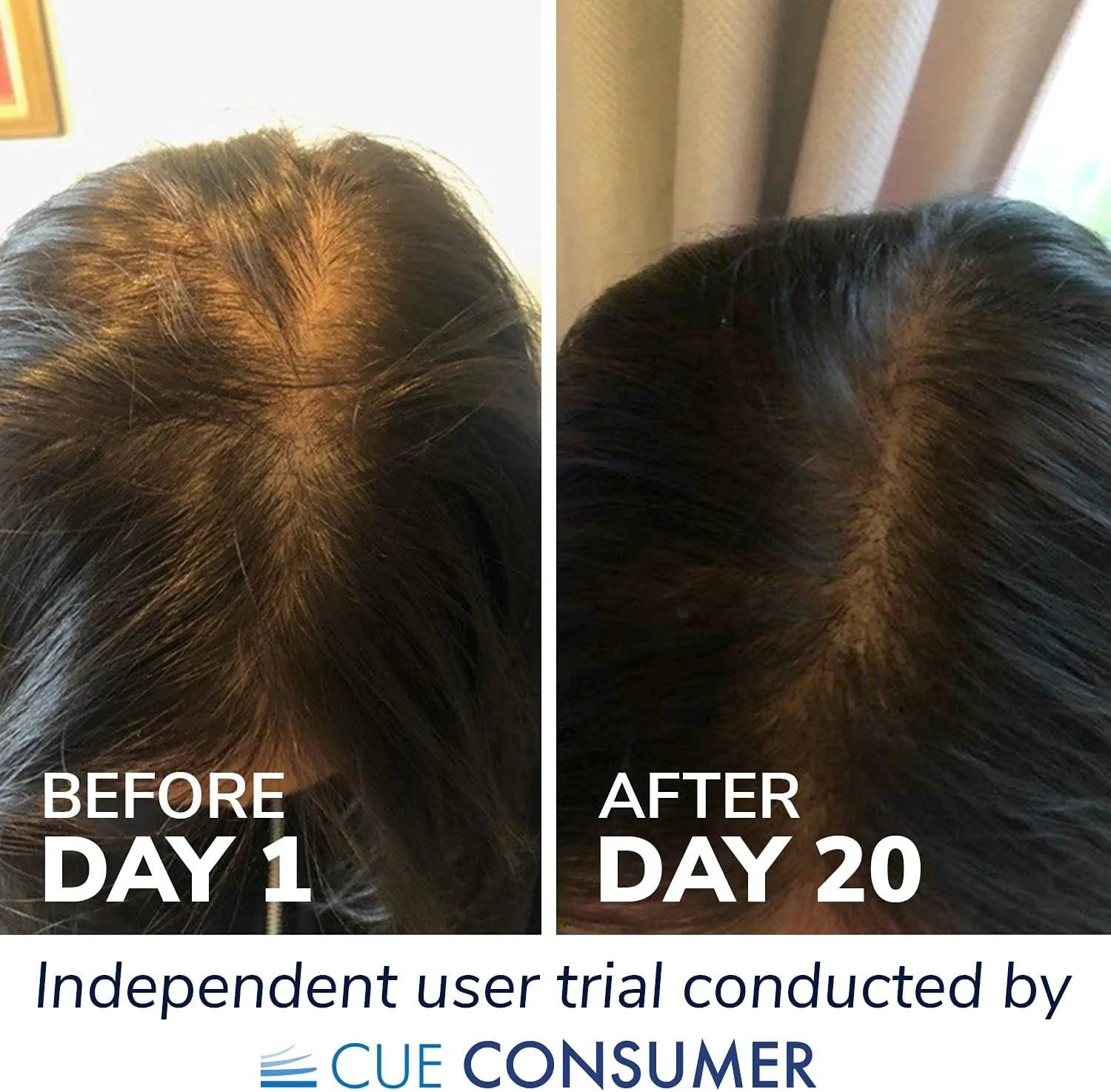 نوشیدنی مکمل مایع کلاژن دریایی ریورس لایف + چای سبز، قدرت بالا 10000 میلی گرم پپتید هیدرولیز شده غنی شده با ویتامین C، D، اسید هیالورونیک و بیوتین برای مو، پوست و ناخن، 500 میلی لیتر نوشیدنی مکمل مایع کلاژن دریایی ریورس لایف + چای سبز، قدرت بالا 10000 میلی گرم پپتید هیدرولیز شده غنی شده با ویتامین C، D، اسید هیالورونیک و بیوتین برای مو، پوست و ناخن، 500 میلی لیتر