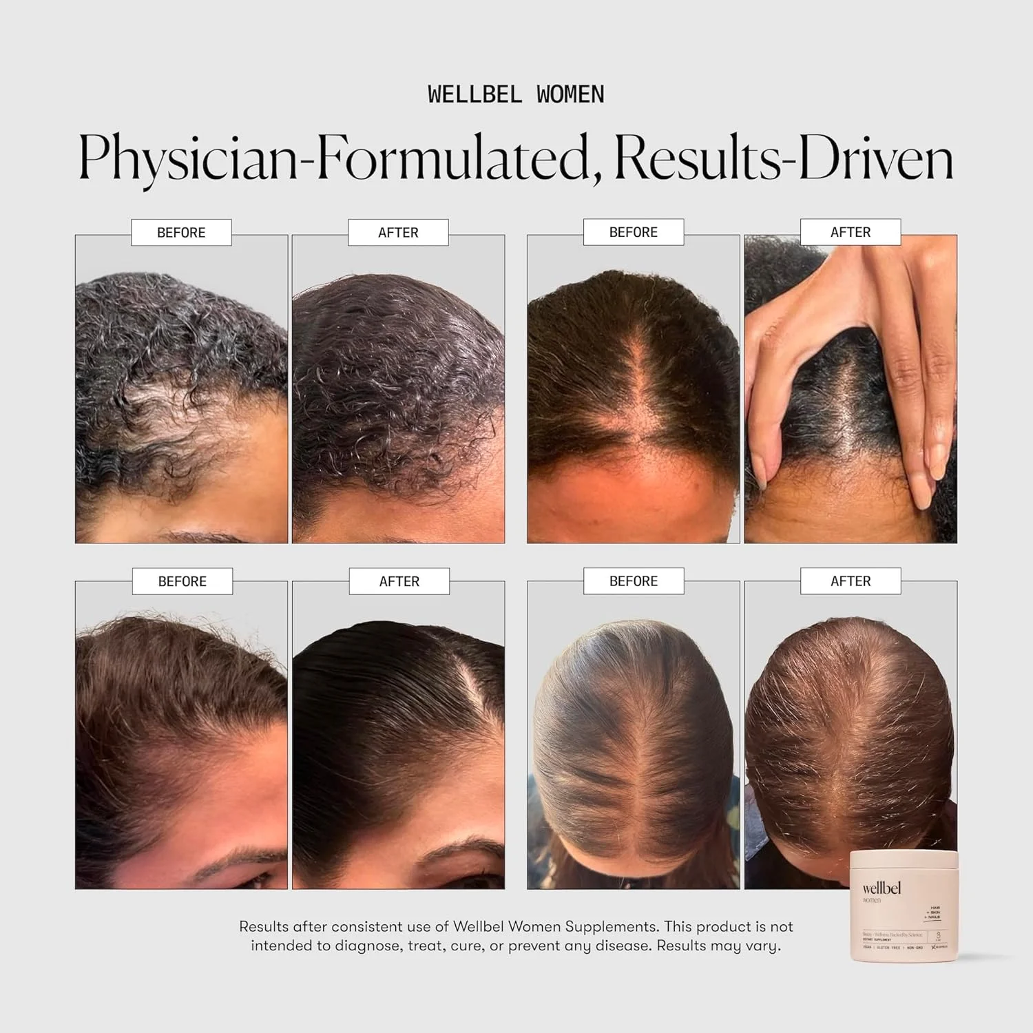 مکمل پاکسازی کننده زنانه ولبل برای مو، پوست و ناخن مکمل پاکسازی کننده زنانه ولبل برای مو، پوست و ناخن