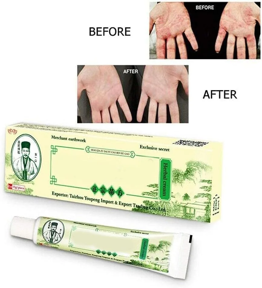 کرم موضعی حساسیت بیش از حد پوستی FDTY برای رفع خارش، درماتیت گیاهی، اگزما و خارش پوست برای مردان و زنان کرم موضعی حساسیت بیش از حد پوستی FDTY برای رفع خارش، درماتیت گیاهی، اگزما و خارش پوست برای مردان و زنان