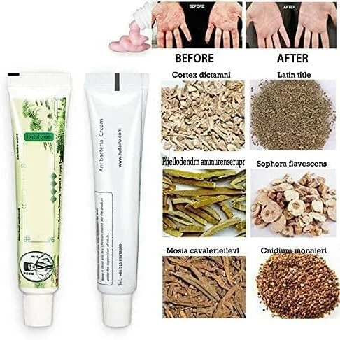 کرم موضعی حساسیت بیش از حد پوستی FDTY برای رفع خارش، درماتیت گیاهی، اگزما و خارش پوست برای مردان و زنان کرم موضعی حساسیت بیش از حد پوستی FDTY برای رفع خارش، درماتیت گیاهی، اگزما و خارش پوست برای مردان و زنان