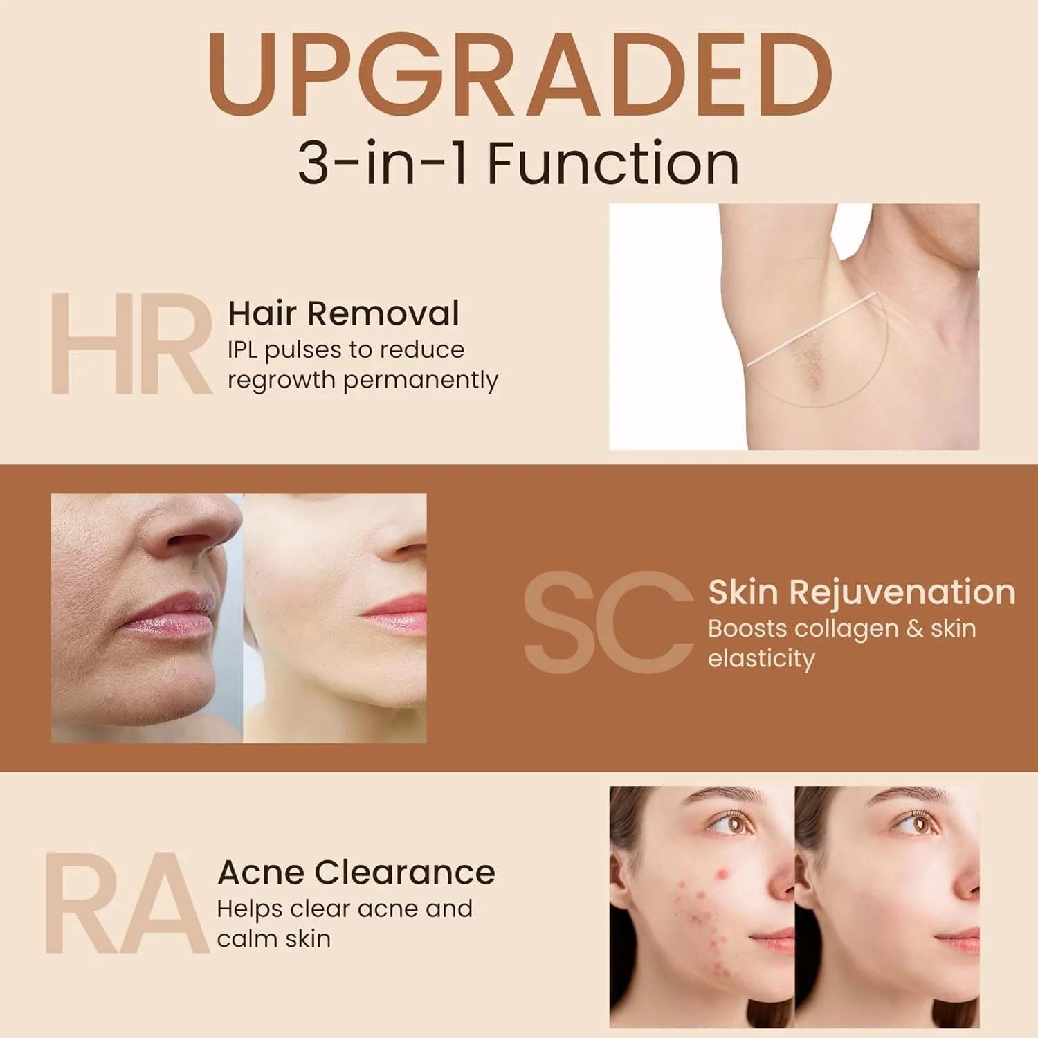 دستگاه لیزر حذف موهای زائد IPL | حذف موهای زائد برای زنان و مردان، 9 سطح انرژی، 999999 پالس - جوانسازی پوست و درمان آکنه، فناوری خنک کننده، حذف موهای زائد لیزری بدون درد و کارآمد دستگاه لیزر حذف موهای زائد IPL | حذف موهای زائد برای زنان و مردان، 9 سطح انرژی، 999999 پالس - جوانسازی پوست و درمان آکنه، فناوری خنک کننده، حذف موهای زائد لیزری بدون درد و کارآمد