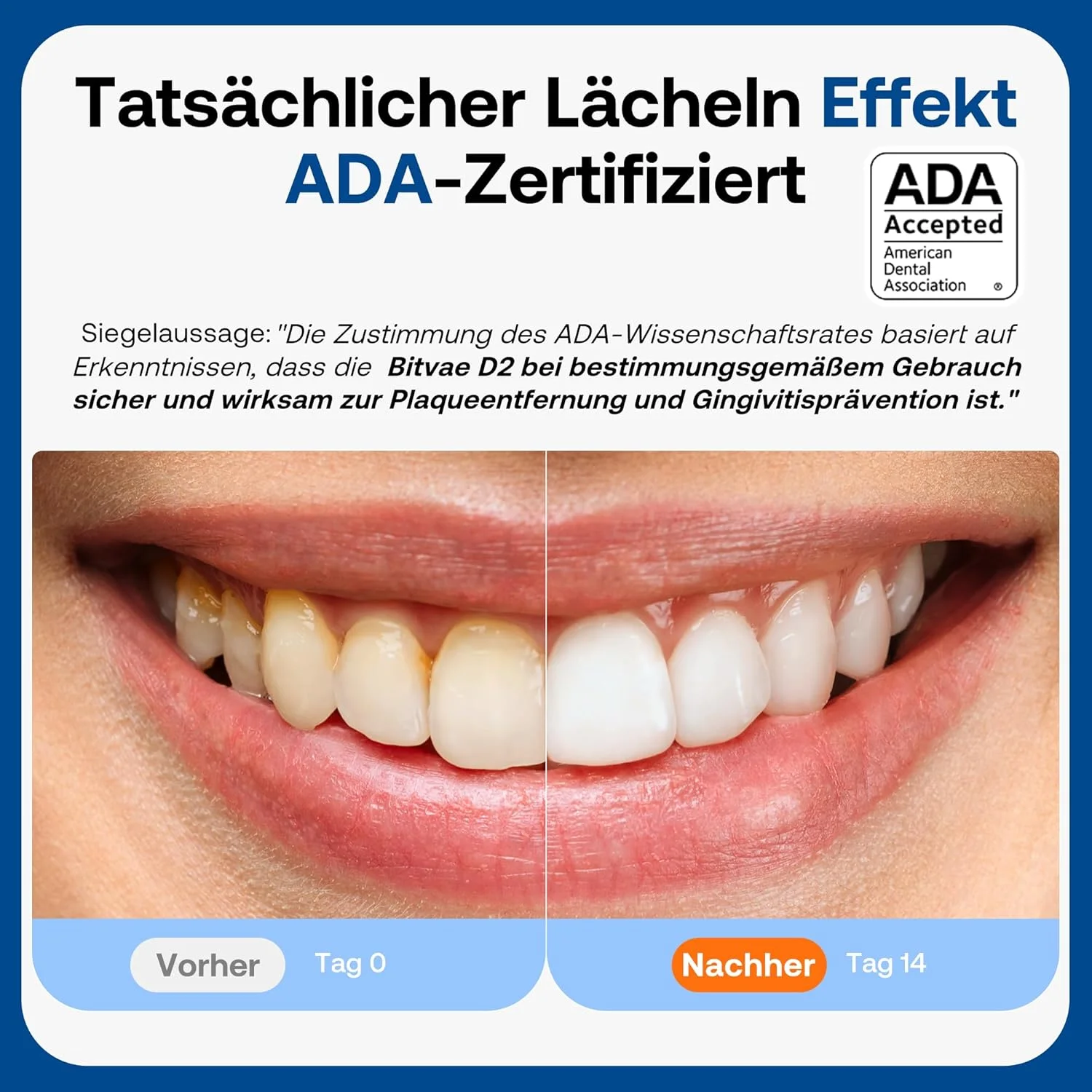 مسواک برقی Bitvae D2 برای بزرگسالان و کودکان، مسواک صوتی قابل شارژ، مسواک اولتراسونیک مسافرتی، مسواک نرم با 8 سری و 5 حالت (مشکی-A)