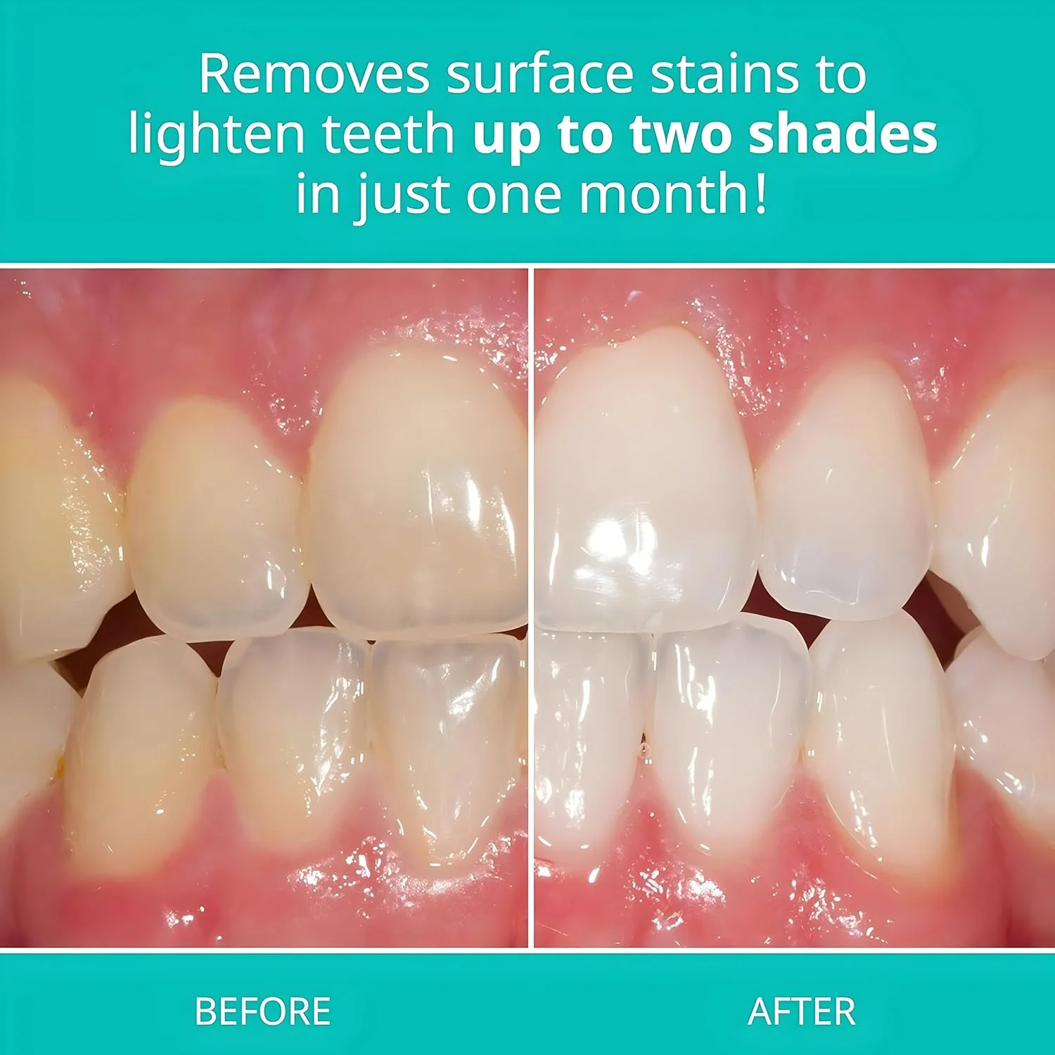 خمیر دندان سفید کننده Opalescence - بسته 1 عددی - مراقبت از دهان و دندان فلوراید - 133 گرم - نعناع خنک - TP-5166-1 خمیر دندان سفید کننده Opalescence - بسته 1 عددی - مراقبت از دهان و دندان فلوراید - 133 گرم - نعناع خنک - TP-5166-1