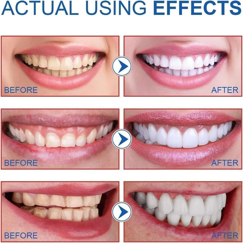 خمیر دندان سفید کننده دندان، 2 عدد SP-6 فوق العاده سفید کننده برای تمیز کردن عمیق مراقبت از دهان و دندان های سالم تر و سفیدتر خمیر دندان سفید کننده دندان، 2 عدد SP-6 فوق العاده سفید کننده برای تمیز کردن عمیق مراقبت از دهان و دندان های سالم تر و سفیدتر