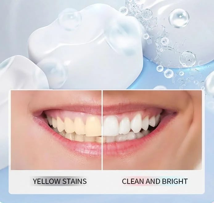 یک بسته خمیر دندان سفید کننده نیاسینامید، خمیر دندان نیاسینامید، دندان های سفیدتر و تنفس تازه، سفید کننده ایمن برای مینای دندان و از بین برنده لکه های طبیعی، ترمیم و محافظت از دندان ها (1 عدد، 1 نعناع)