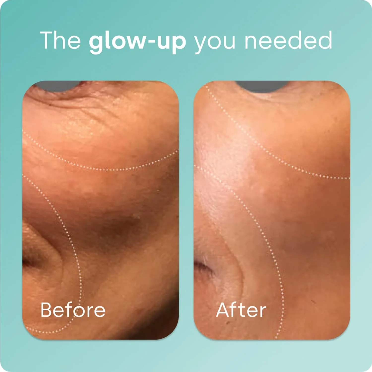 بایو سیل - 120 کپسول گیاهی - حاوی کمپلکس ثبت شده ch-OSA - افزایش تولید کلاژن برای مو، پوست و ناخن های زیبا - بدون GMO - 120 سروینگ