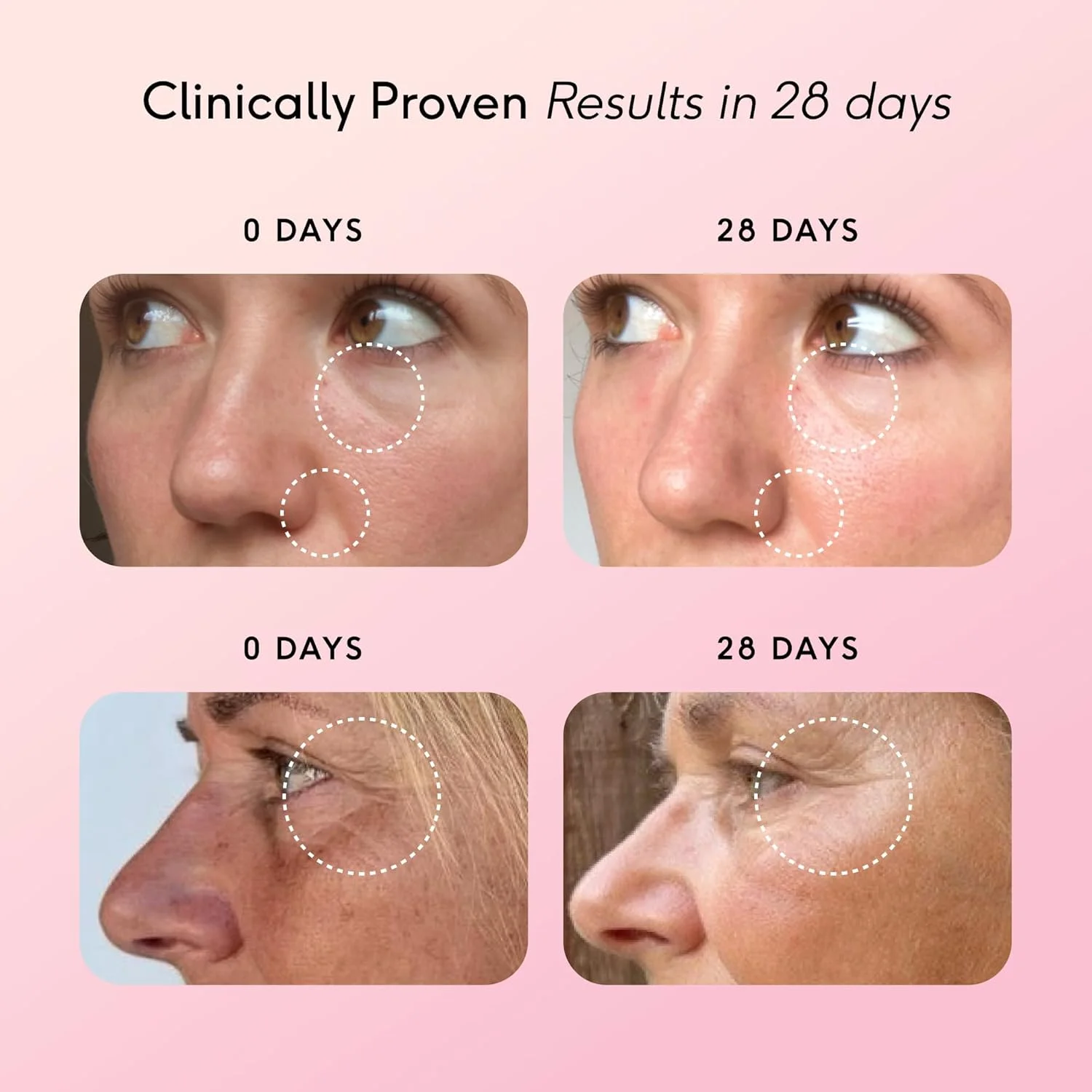 ژل کلاژن Feel Pro، طعم گیلاس، 5 گرم کلاژن در هر وعده، بدون گلوتن، تقویت کننده سلامت مو، زیبایی پوست و استحکام ناخن، ژل مایع (30 ژل) ژل کلاژن Feel Pro، طعم گیلاس، 5 گرم کلاژن در هر وعده، بدون گلوتن، تقویت کننده سلامت مو، زیبایی پوست و استحکام ناخن، ژل مایع (30 ژل)