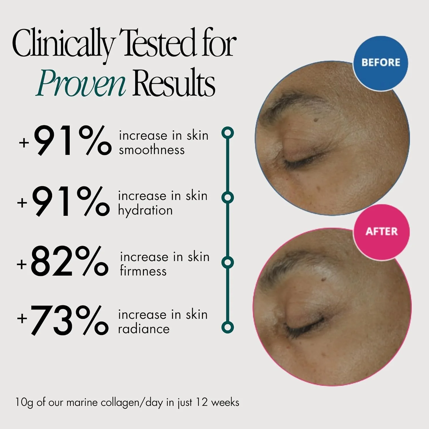پودر پپتیدهای کلاژن دریایی 3 در 1 + آنتی اکسیدان ویتامین C ارگانیک + بیوتین برای زیبایی مو، پوست و ناخن، مکمل پودر کلاژن هیدرولیز شده غیر GMO، کلاژن برای زنان و مردان، 320 گرم پودر پپتیدهای کلاژن دریایی 3 در 1 + آنتی اکسیدان ویتامین C ارگانیک + بیوتین برای زیبایی مو، پوست و ناخن، مکمل پودر کلاژن هیدرولیز شده غیر GMO، کلاژن برای زنان و مردان، 320 گرم