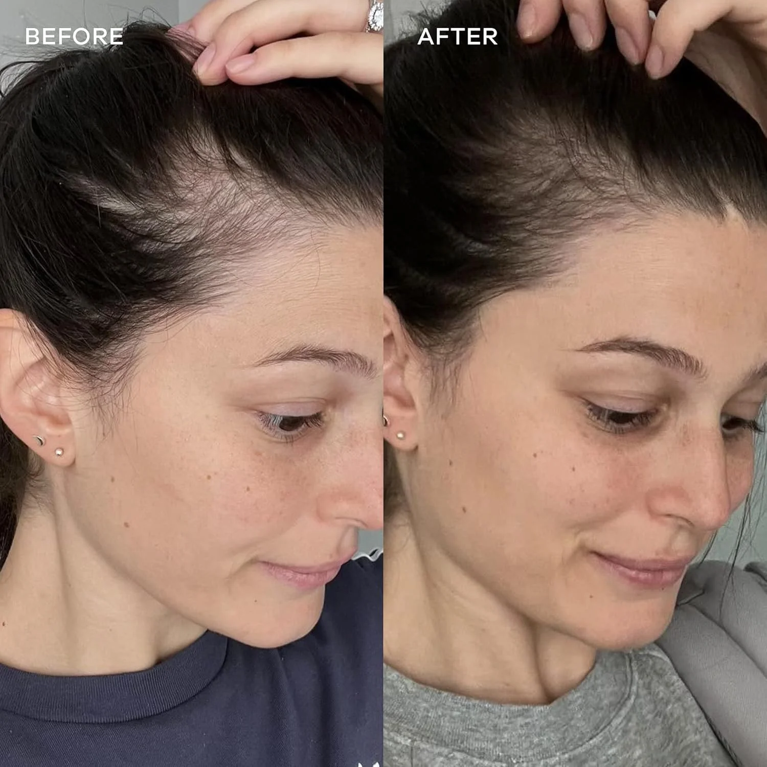 ویدا گلو - ساشه های کلاژن دریایی هیدرولیز شده طبیعی | افزایش درخشندگی پوست + صاف کننده خطوط ریز (هلو، 30 ساشه)