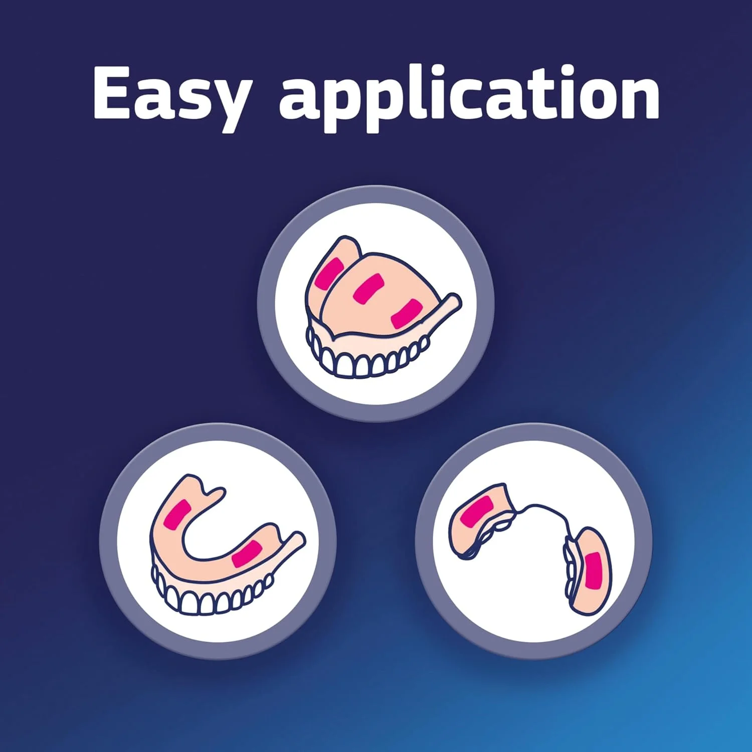 چسب دندان مصنوعی فیکسودنت کامپلیت نوترال - 40 گرم چسب دندان مصنوعی فیکسودنت کامپلیت نوترال - 40 گرم