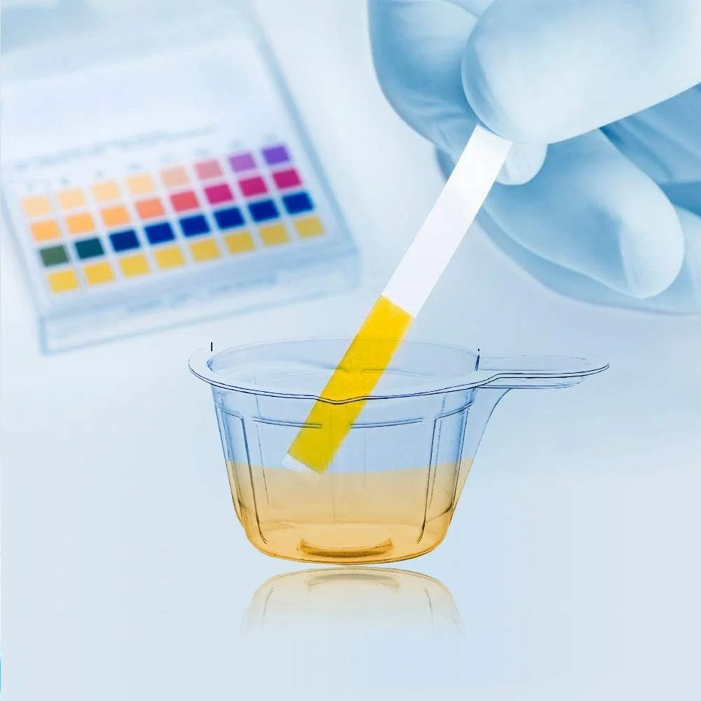 فنجان ادرار یکبار مصرف پلاستیکی 40 میلی لیتری - 100 عدد فنجان نمونه ادرار برای جمع آوری آسان نمونه ادرار برای تست بارداری، تست تخمک گذاری (100 عدد)