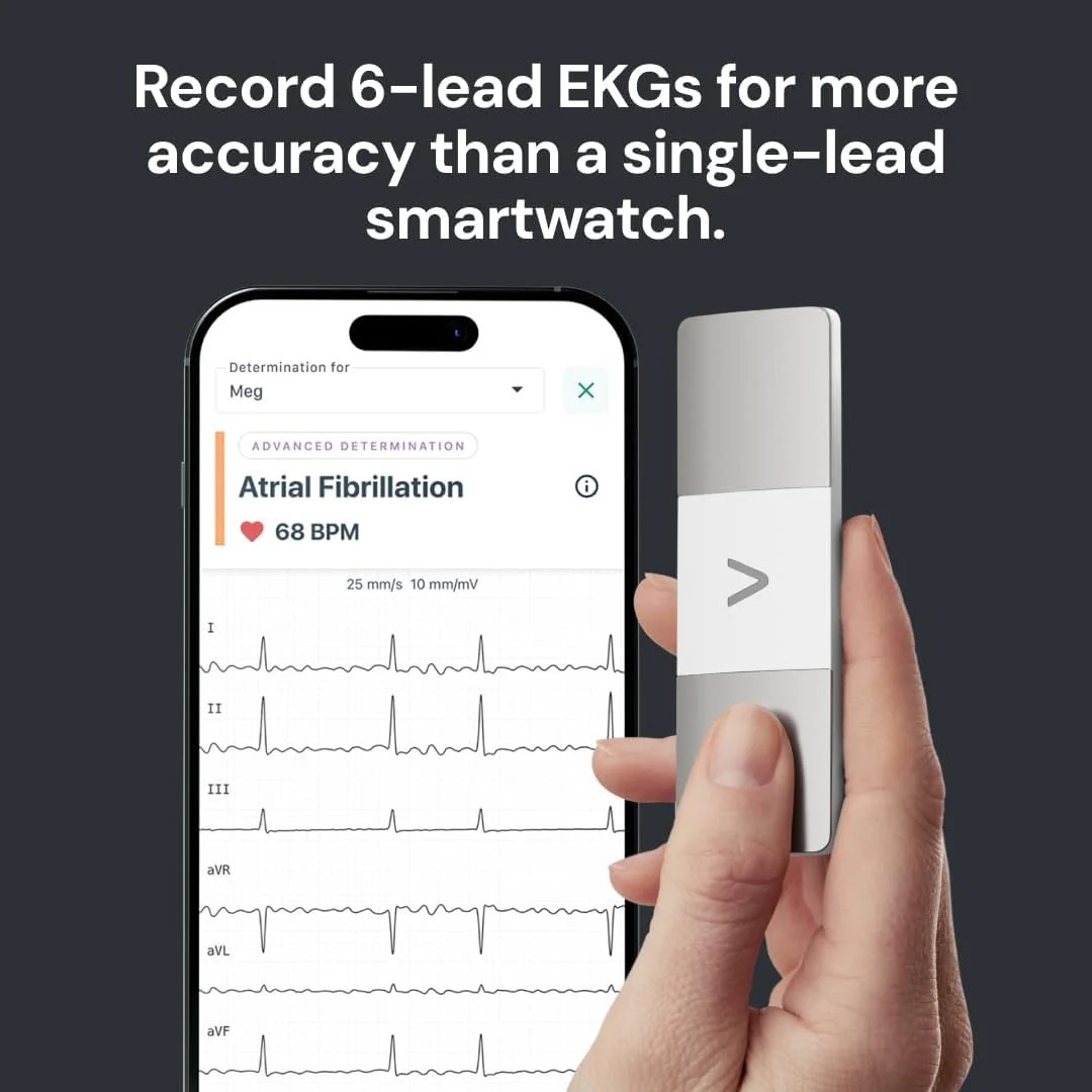 دستگاه نوار قلب شخصی AliveCor KardiaMobile – 6 لید - ثبت نوار قلب در خانه - تشخیص ضربان قلب نامنظم و آریتمی های نامنظم - شامل 1 سال دسترسی - سازگار با اکثر تلفن های هوشمند