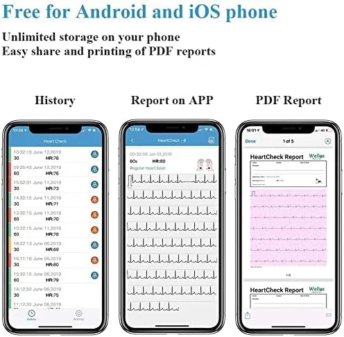 دستگاه تست نوار قلب قابل حمل JJFF با اپلیکیشن رایگان و نرم افزار کامپیوتر - پایش 24 ساعته ضربان قلب در خانه