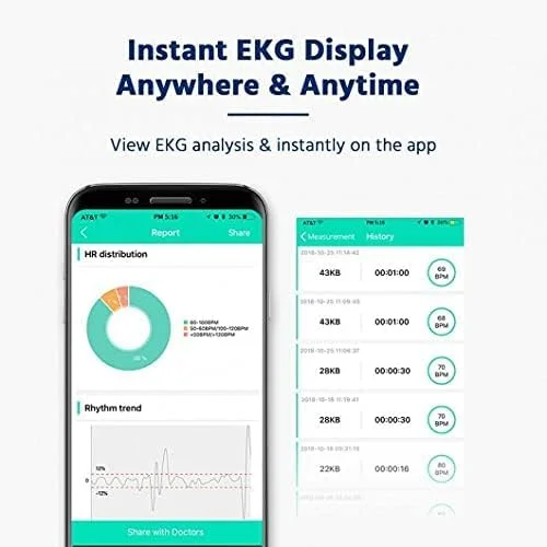 دستگاه نوار قلب SnapECG، دستگاه پایش ضربان قلب دستی برای تلفن هوشمند، ردیابی بی سیم ریتم قلب بدون الکترود، دستگاه قابل حمل EKG برای آیفون و اندروید دستگاه نوار قلب SnapECG، دستگاه پایش ضربان قلب دستی برای تلفن هوشمند، ردیابی بی سیم ریتم قلب بدون الکترود، دستگاه قابل حمل EKG برای آیفون و اندروید