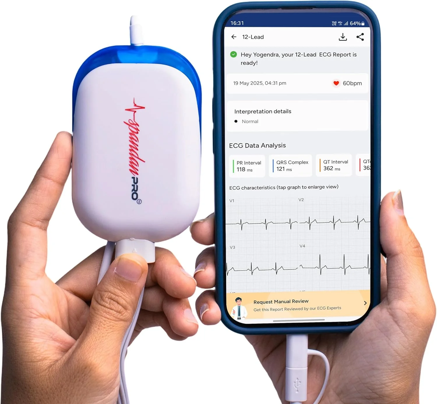 دستگاه نوار قلب 12 کاناله Sunfox Spandan Pro | نوار قلب چند کاناله با 10 سیم | طراحی ویژه برای پزشکان | دستگاه نوار قلب قابل حمل برای کلینیک | سیستم نوار قلب Goldberger | 99.7%