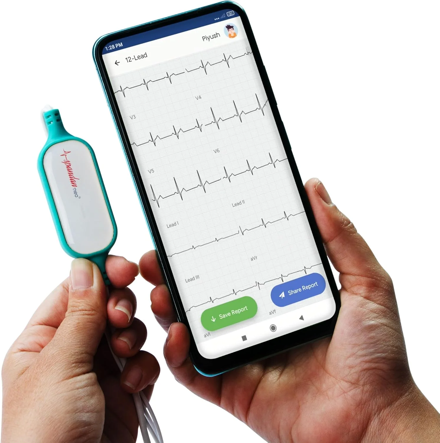 دستگاه نوار قلب خانگی سان‌فاکس اسپندان نئو | تشخیص AFib و آریتمی‌های نامنظم | دستگاه نوار قلب قابل حمل برای منزل | مناسب برای مسافرت و استفاده در منزل | دستگاه نوار قلب 12 لید با 12 الکترود