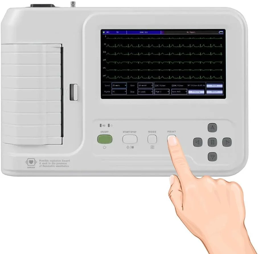 دستگاه الکتروکاردیوگراف ECG قابل حمل 12 لید با صفحه نمایش لمسی 7 اینچی LCD و سیستم چاپ حرارتی