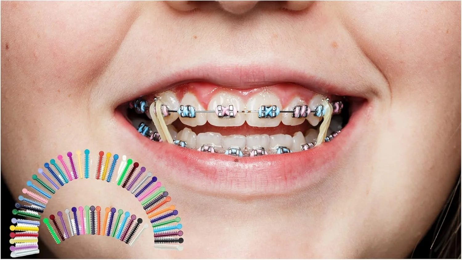 کش های رنگی ارتودنسی آرتمن، چند رنگ، 1040 عدد، سیم های ارتودنسی برای دندان، تعویض آسان، کش های رنگی ارتودنسی کش های رنگی ارتودنسی آرتمن، چند رنگ، 1040 عدد، سیم های ارتودنسی برای دندان، تعویض آسان، کش های رنگی ارتودنسی