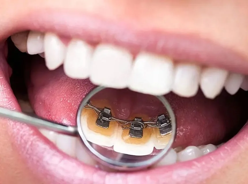 آینه دندانپزشکی RYN، ابزار آینه دهانی استیل ضد زنگ، ابزار بازتابنده بازرسی، آینه دندانپزشکی خمیده برای ابزار مراقبت از دهان و آینه کوچک آرایشی آینه دندانپزشکی RYN، ابزار آینه دهانی استیل ضد زنگ، ابزار بازتابنده بازرسی، آینه دندانپزشکی خمیده برای ابزار مراقبت از دهان و آینه کوچک آرایشی