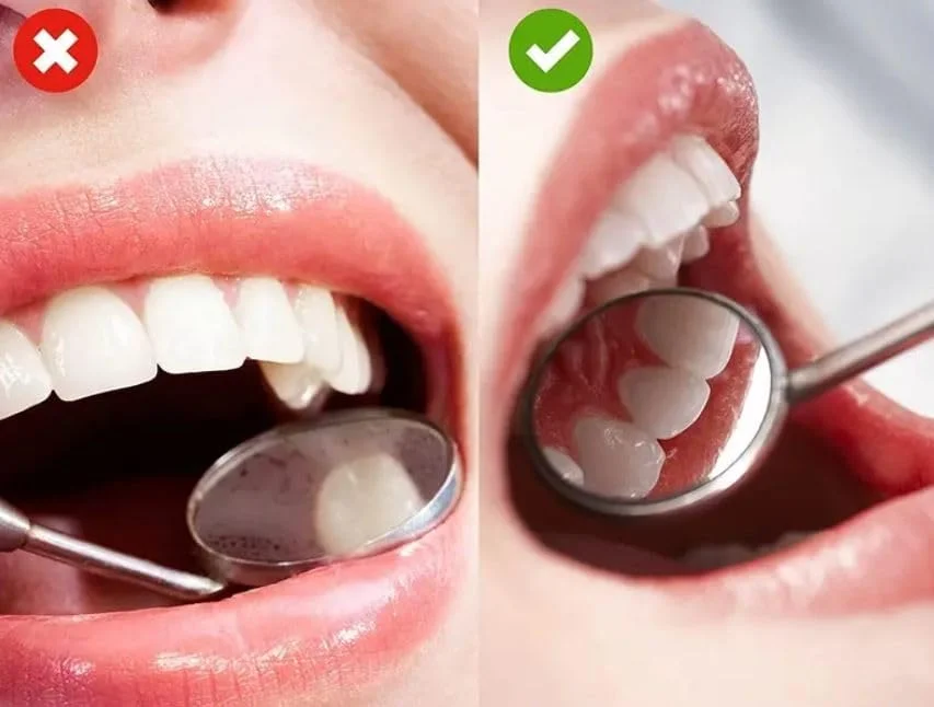 آینه دندانپزشکی RYN، ابزار آینه دهانی استیل ضد زنگ، ابزار بازتابنده بازرسی، آینه دندانپزشکی خمیده برای ابزار مراقبت از دهان و آینه کوچک آرایشی آینه دندانپزشکی RYN، ابزار آینه دهانی استیل ضد زنگ، ابزار بازتابنده بازرسی، آینه دندانپزشکی خمیده برای ابزار مراقبت از دهان و آینه کوچک آرایشی