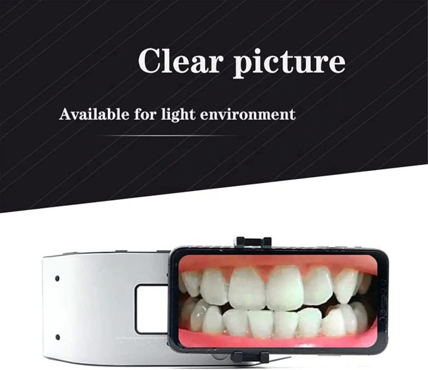 نور عکاسی دندانپزشکی موبایل SOLUK، نگهدارنده موبایل LED عکاسی دندانپزشکی 6500K، نور LED دهانی دندانپزشکی برای عکاسی موبایل و نور پرکننده نور عکاسی دندانپزشکی موبایل SOLUK، نگهدارنده موبایل LED عکاسی دندانپزشکی 6500K، نور LED دهانی دندانپزشکی برای عکاسی موبایل و نور پرکننده