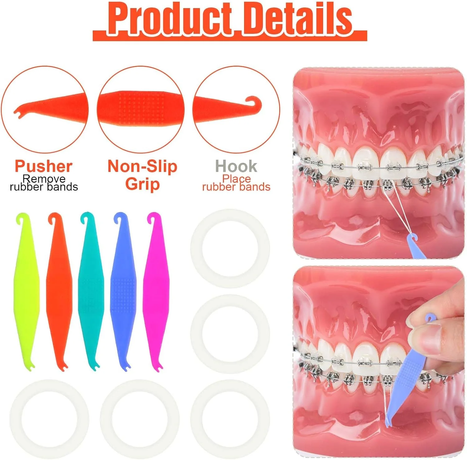 کش های ارتودنسی