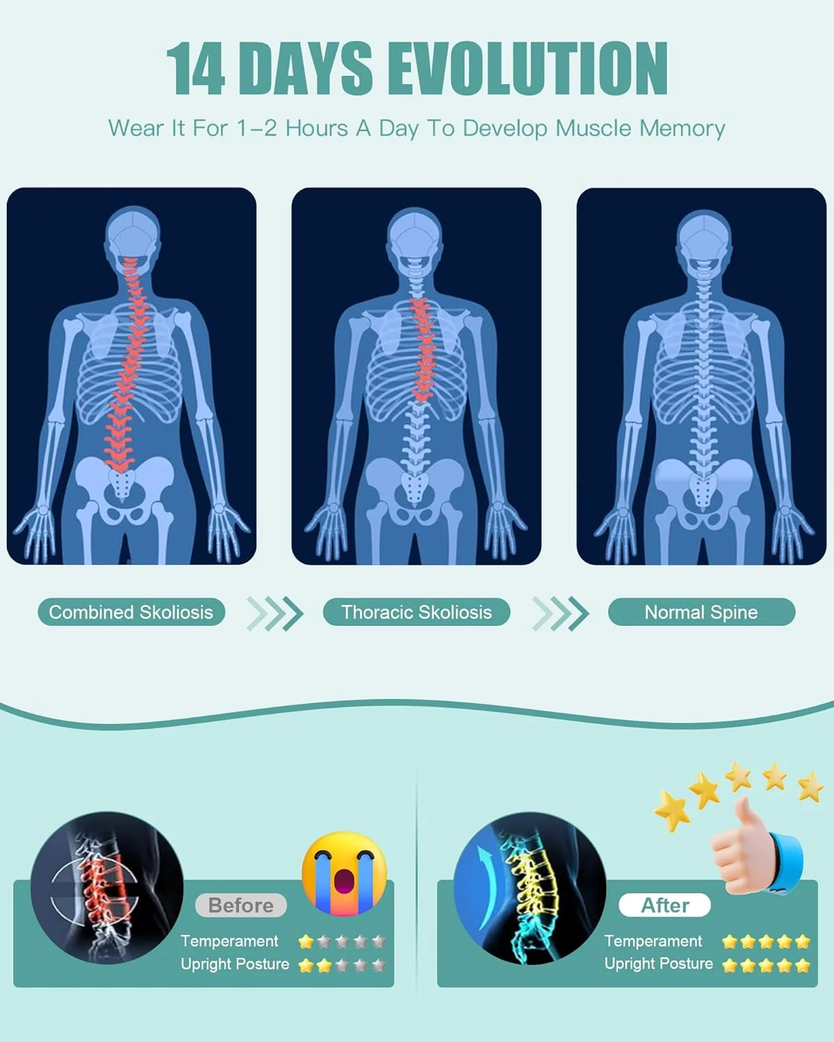 اصلاح کننده وضعیت بدن برای زنان و مردان - پشتیبانی کامل از کمر برای بهبود وضعیت بدن و اصلاح قوز کمر و تسکین ناراحتی در قسمت فوقانی و تحتانی کمر، گردن و شانه (متوسط) اصلاح کننده وضعیت بدن برای زنان و مردان - پشتیبانی کامل از کمر برای بهبود وضعیت بدن و اصلاح قوز کمر و تسکین ناراحتی در قسمت فوقانی و تحتانی کمر، گردن و شانه (متوسط)