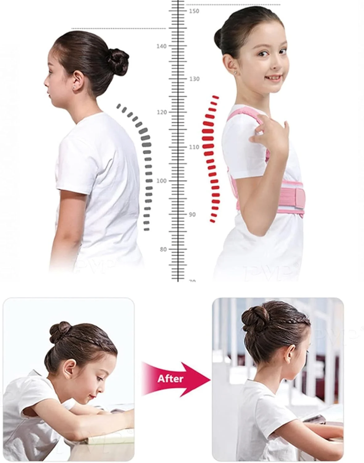 اصلاح کننده وضعیت بدن کودکان، کرست ارتوپدی، پشتیبانی از شانه، کمر و گودی کمر برای صاف کردن کمربند بالاتنه کودکان و نوجوانان (رنگ: صورتی، سایز: XL)