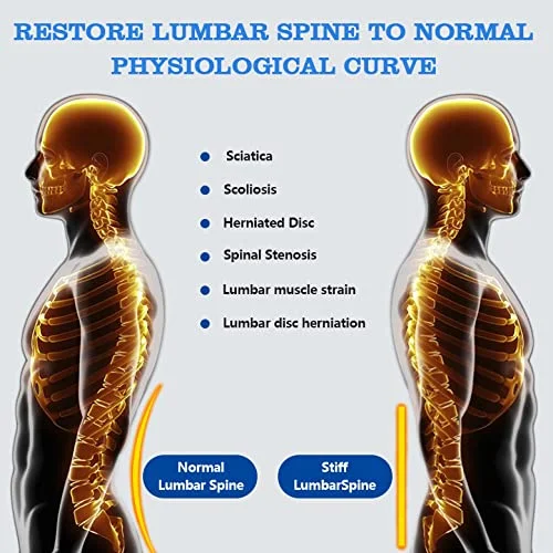 کمربند طبی کمر Nvorliy مناسب برای زنان و مردان، کمربند کمری فشاری قابل تنظیم برای سیاتیک، فتق دیسک، بهبودی پس از عمل، کشیدگی و تنگی کانال نخاع (ایکس لارج)