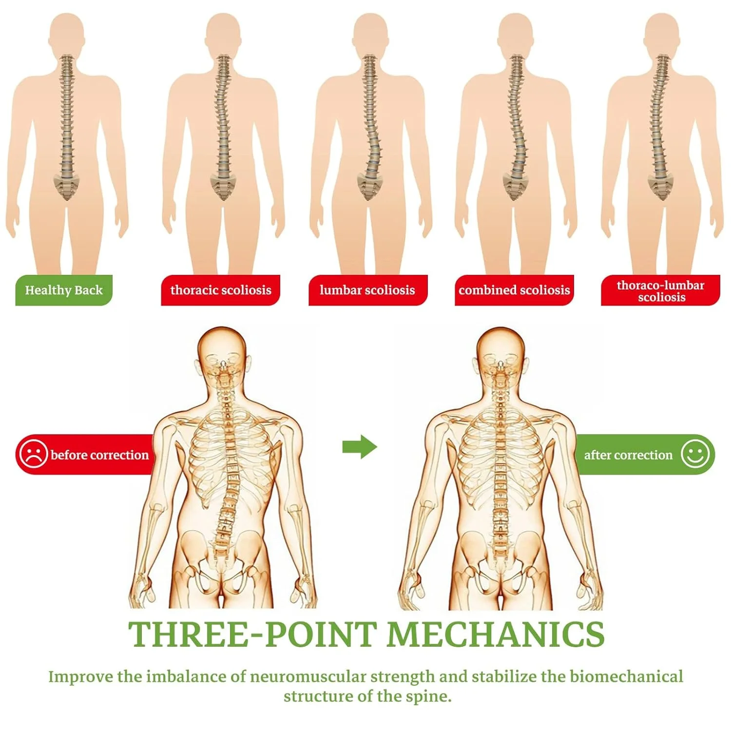اصلاح کننده وضعیت بدن اسکولیوز ماژونکی، بریس ثابت قابل تنظیم برای کیفوز، پوکی استخوان، بهبودی پس از عمل جراحی، مناسب برای آقایان و بانوان اصلاح کننده وضعیت بدن اسکولیوز ماژونکی، بریس ثابت قابل تنظیم برای کیفوز، پوکی استخوان، بهبودی پس از عمل جراحی، مناسب برای آقایان و بانوان