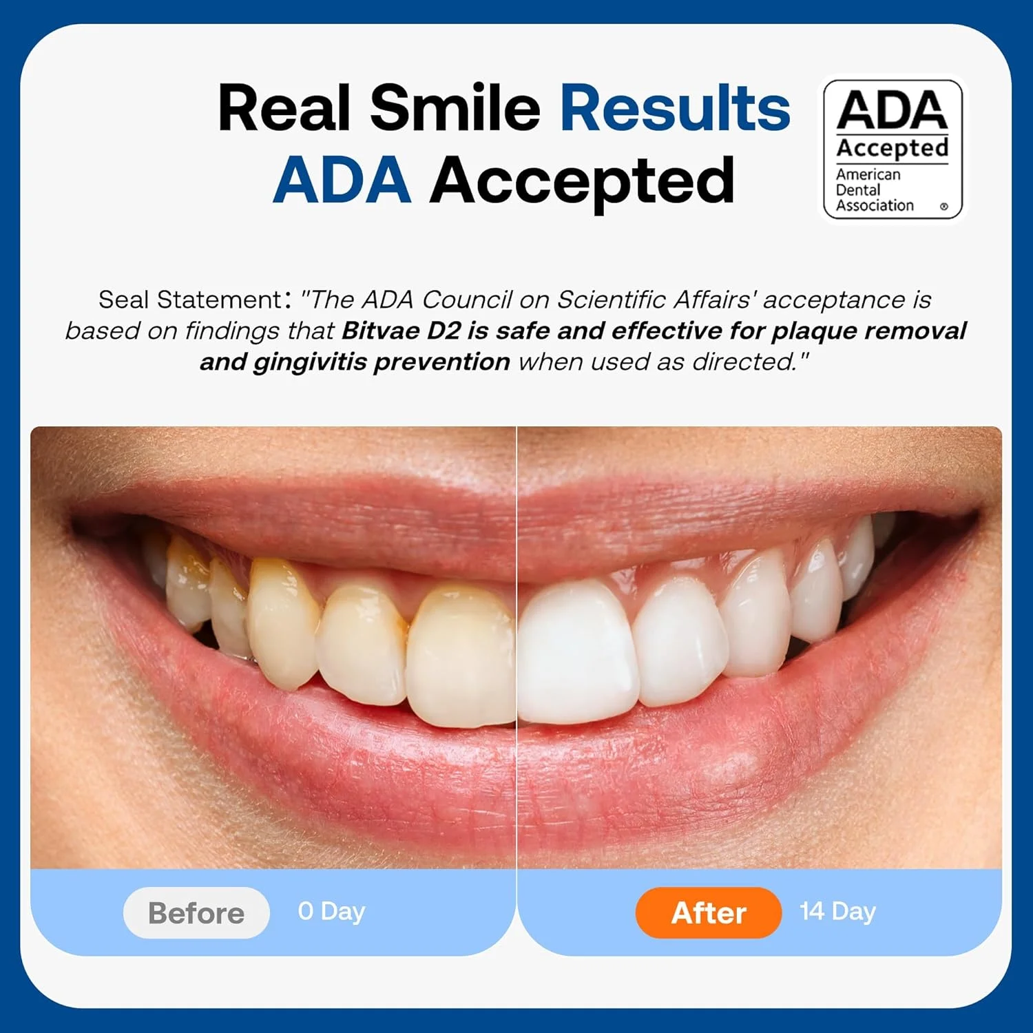 مسواک برقی اولتراسونیک Bitvae برای بزرگسالان و کودکان، مسواک برقی مسافرتی با باتری قابل شارژ 60 روزه، 8 سری، 5 حالت، جعبه/نگهدارنده، صورتی کوارتز