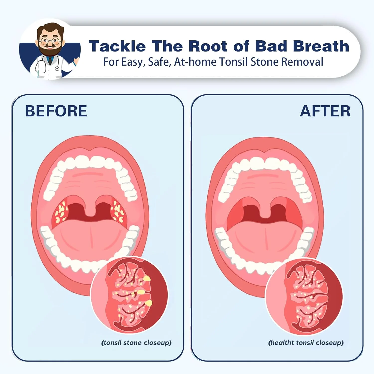 دستگاه الکترونیکی مکش سنگ لوزه - کیت حذف سنگ لوزه - مکش فوری رایگان - شامل چراغ دهانی، دهانشویه، آینه بزرگنمایی 5 برابر، ابزار حذف سنگ لوزه با مکش فوری (مشکی) دستگاه الکترونیکی مکش سنگ لوزه - کیت حذف سنگ لوزه - مکش فوری رایگان - شامل چراغ دهانی، دهانشویه، آینه بزرگنمایی 5 برابر، ابزار حذف سنگ لوزه با مکش فوری (مشکی)