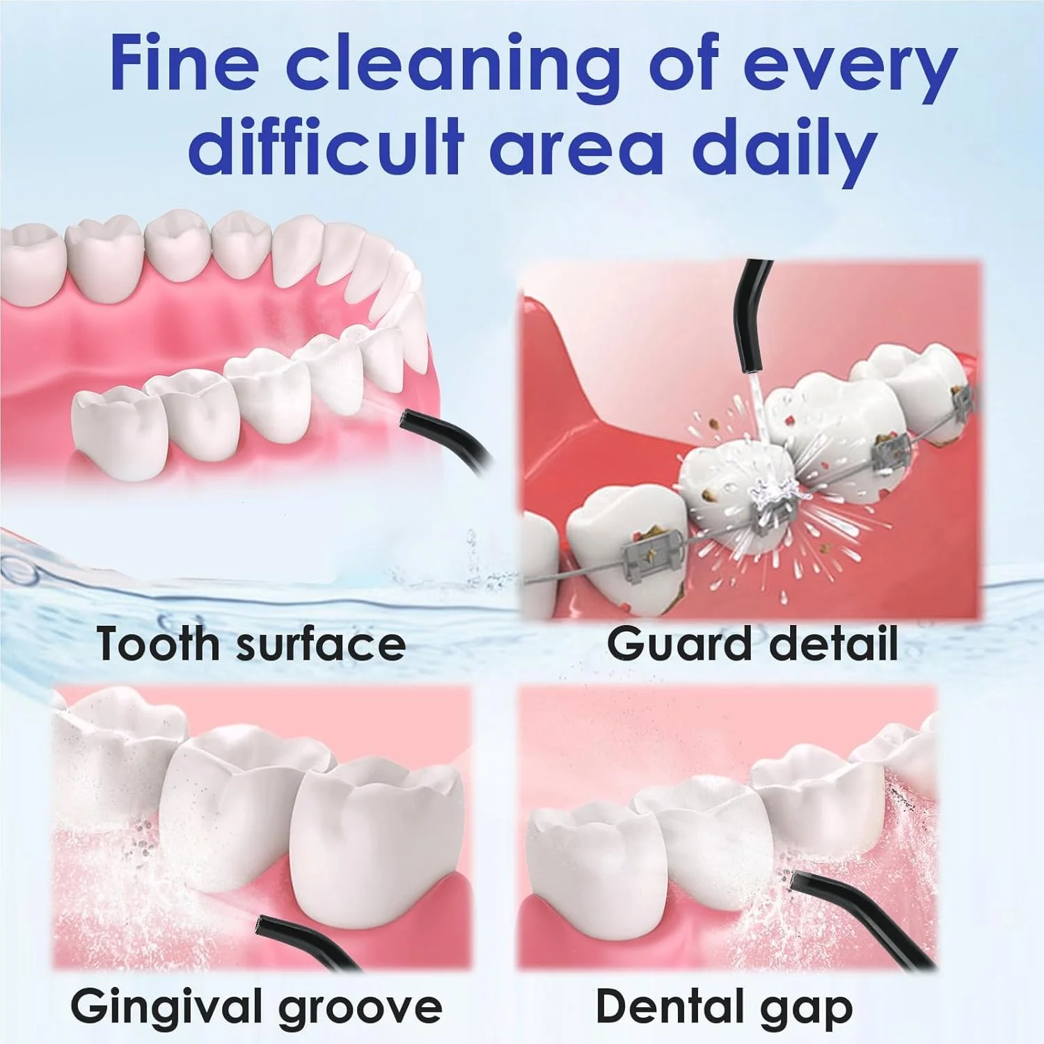 3 عدد سری جایگزین نخ دندان آبی برای دستگاه های نخ دندان آبی هانگسان نیکول کاسلوس ماسپرو زرهان، نازل جت دستگاه شستشوی دهان، سری برای مراقبت موثر از دهان، مشکی